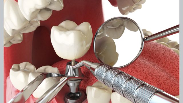 Dental Care